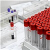 «Проблема распространения ВИЧ остается актуальной»: красноярцев бесплатно проверят на инфекцию 