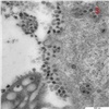 Красноярцам показали новый штамм ковида «омикрон» под микроскопом