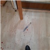 В Черемушках пьяный красноярец с ножом напал на полицейского. Дебошира обезвредили выстрелами