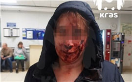 В Емельяновском районе женщина получила монтировкой по лицу из-за споров в дачном чате