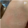 Красноярский Роспотребнадзор опроверг сообщение о новых опасных «наноклещах» 